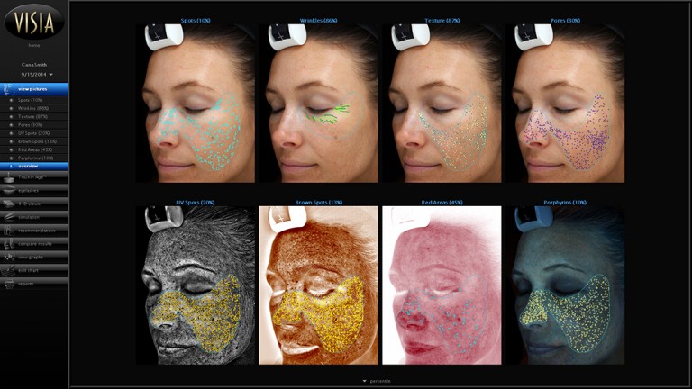 Visia Complexion Analysis | Plastic Surgery Specialists